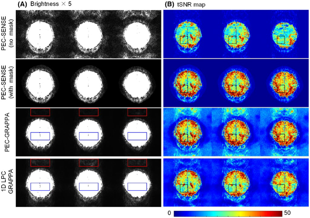 Image Reconstruction