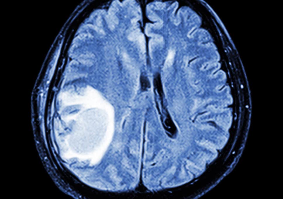 Ultra-low-field MRI