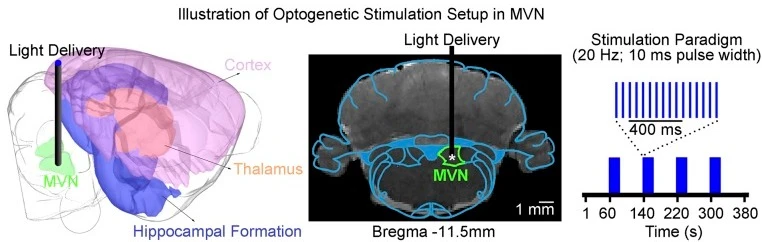 Preclinical Neuroimaging