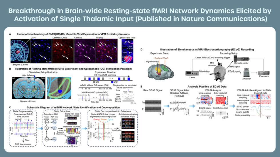 fMRI Network Dynamics Research