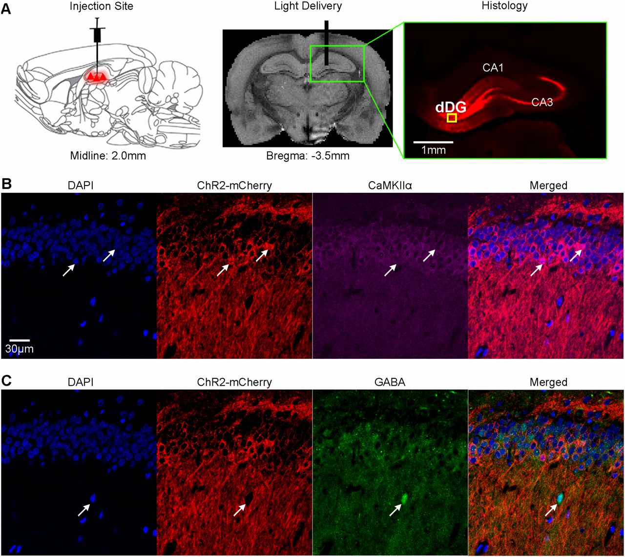 Hippocampal-cortical Connectivity Research