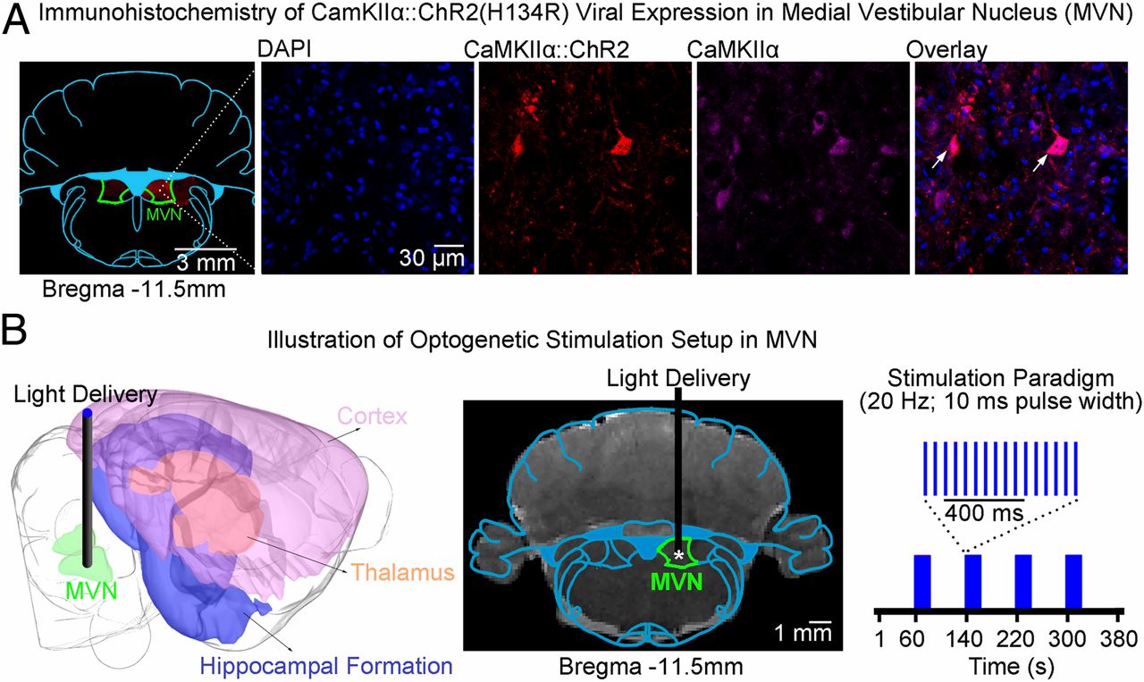 Vestibular Pathways fMRI Research