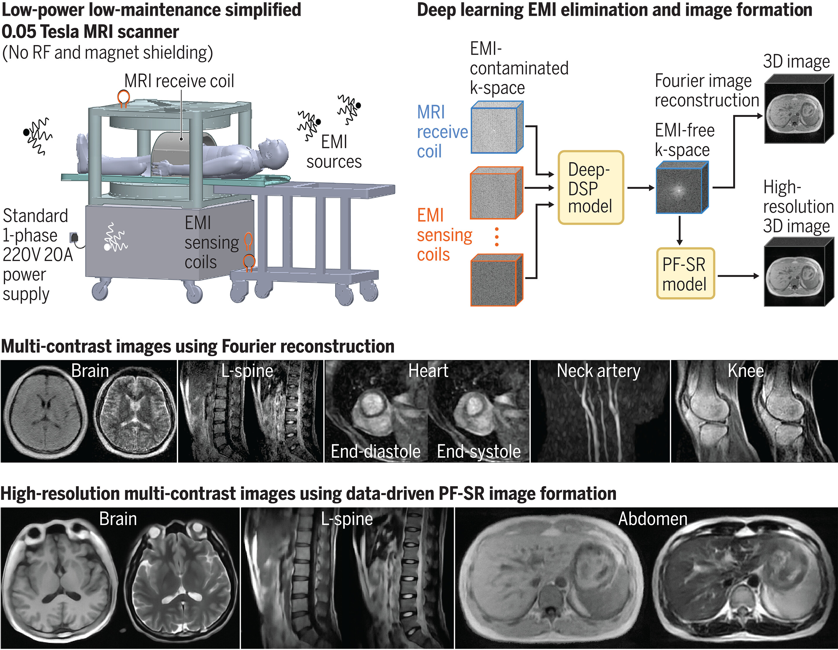 Whole-body MRI Research