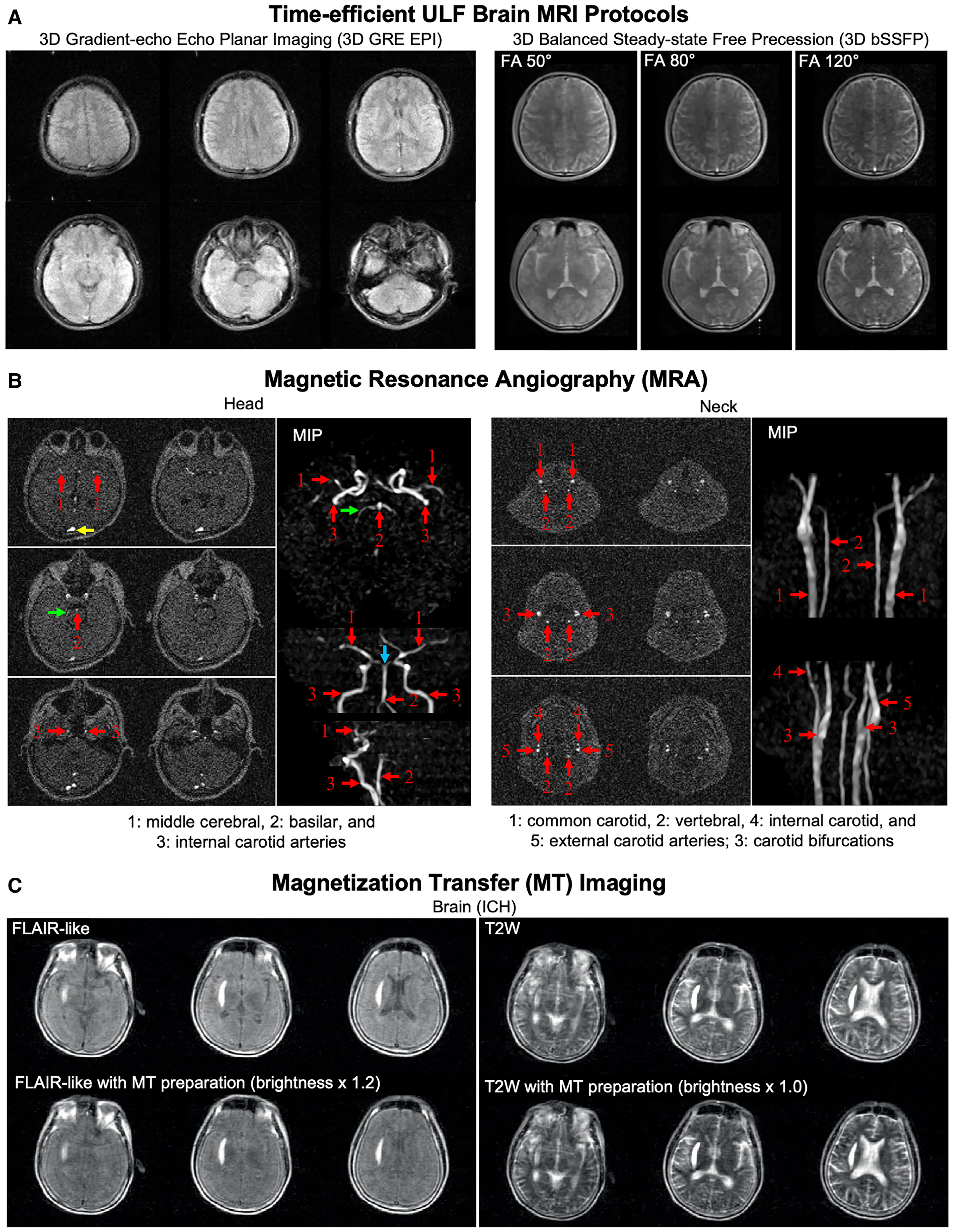 Ultra-low-field brain MRI protocols, angiography, and magnetization transfer imaging