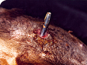 Steel catheters are implanted in the abdomen of bears for bile extraction
(Courtesy of Animals Asia)